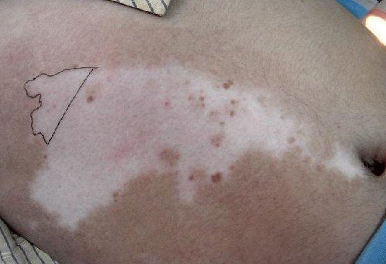  Ҫ��ô��������Ԥ��������ɢ