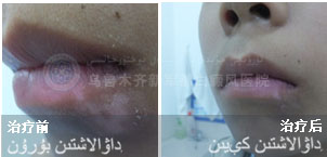 ��ĳ/����/������/��ǰװ�