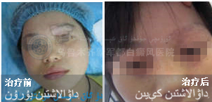 �۽ǰװ�/ɢ����/Ů��/24��