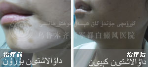 ���װ� 23�� ��չ�� ������